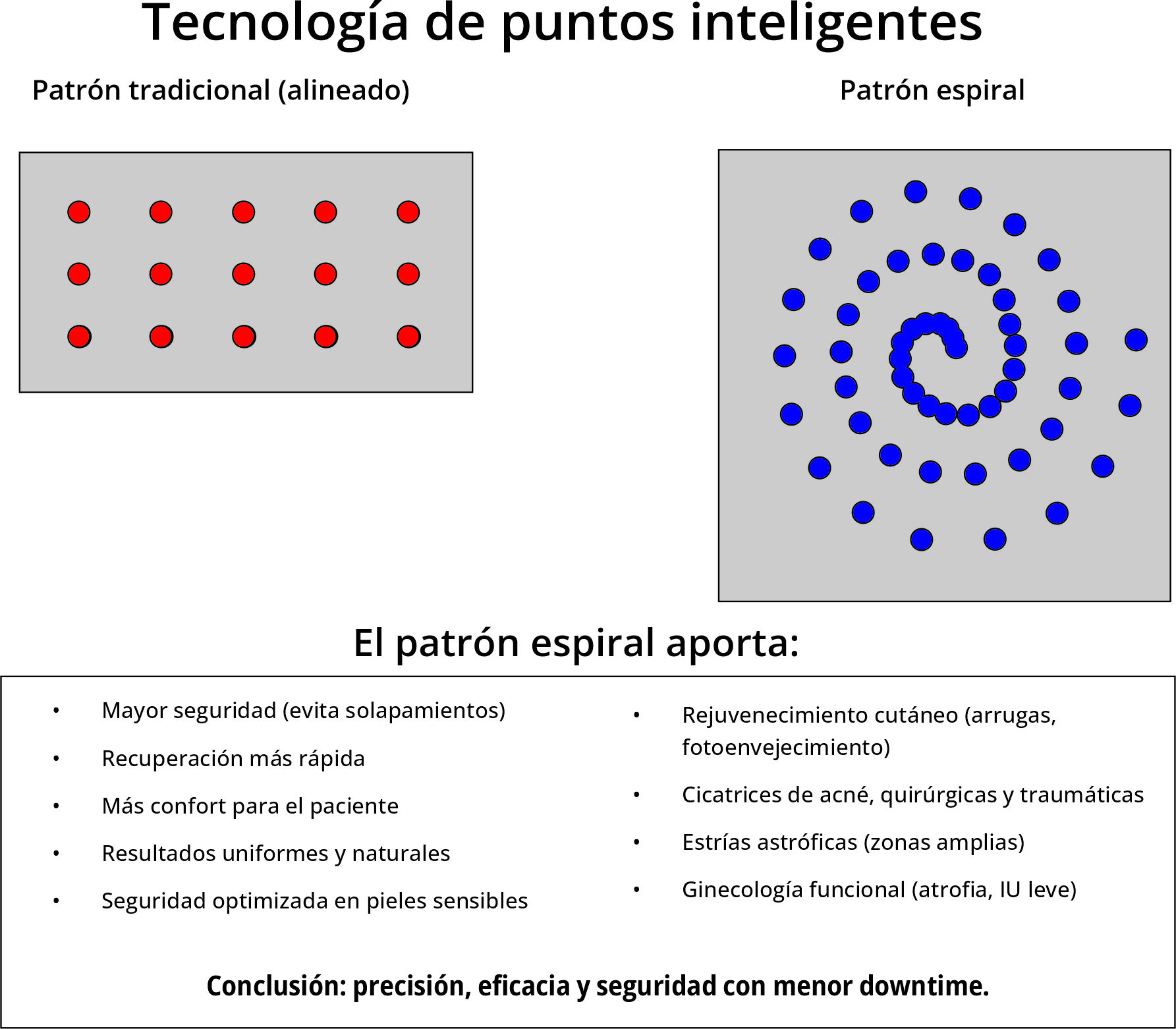 Espieralfrentelineal esquemavr